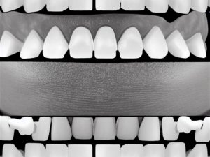 Leczenie ortodontyczne &#8211; diagnoza i plan leczenia